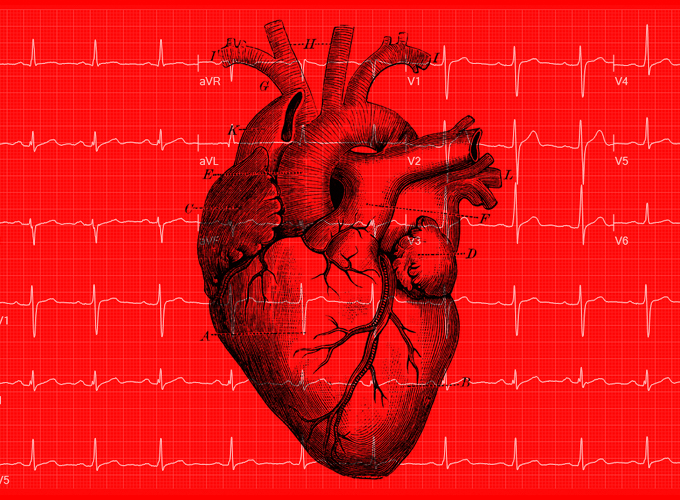 heart-ecg